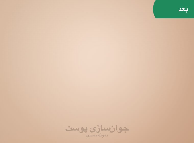 بعد: جوان‌سازی پوست