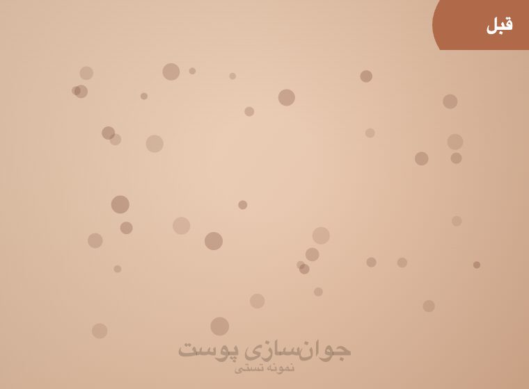 قبل: جوان‌سازی پوست