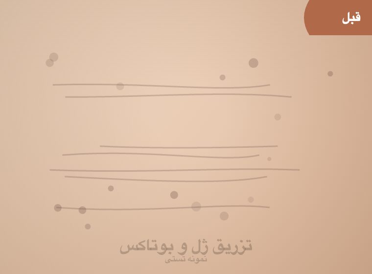 اتاق لیزر