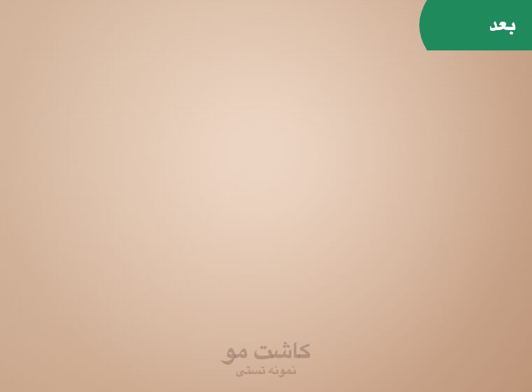 اتاق لیزر