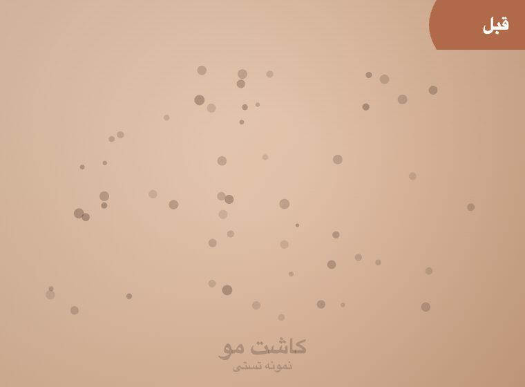اتاق لیزر